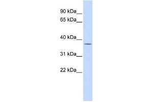 WB Suggested Anti-PAntibody Titration:  0. (PARP16 抗体  (Middle Region))