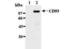 Western Blotting (WB) image for anti-CD93 (CD93) antibody (ABIN1449221) (CD93 抗体)