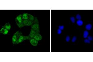 Immunofluorescence analysis of HeLa cells using CREB1 antibody (ABIN5996963). (CREB1 抗体)