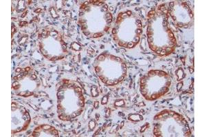 Immunohistochemistry (IHC) image for anti-Vimentin (VIM) antibody (ABIN7426163)
