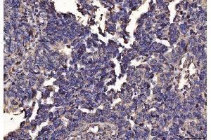 IHC analysis of PDIA6 using anti-PDIA6 antibody (ABIN7600554). (PDIA6 抗体  (AA 20-440))