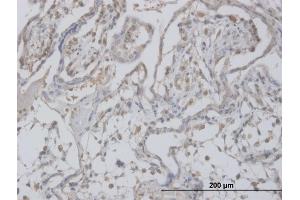 Immunoperoxidase of monoclonal antibody to CLIC1 on formalin-fixed paraffin-embedded human placenta. (CLIC1 抗体  (AA 1-241))
