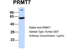 Host:  Rabbit  Target Name:  PRMT7  Sample Type:  Human 293T  Antibody Dilution:  1. (PRMT7 抗体  (N-Term))