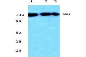 Western blot analysis of c-Abl antibody at 1/500 dilution in HepG2 whole cell lysate (Lane 1), Mouse (Lane 2) and Rat (Lane 3) liver tissue lysates. (ABL1 抗体)