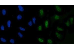 IF analysis of GLIS1 using anti-GLIS1 antibody (ABIN7599501).
