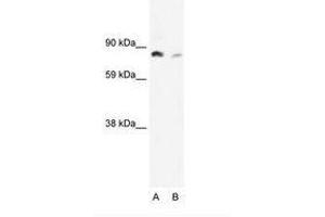 Image no. 2 for anti-Nuclear Factor of kappa Light Polypeptide Gene Enhancer in B-Cells 2 (NFKB2) (AA 65-114) antibody (ABIN6735898)
