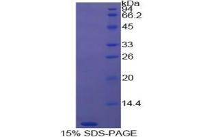 SDS-PAGE analysis of Cow Thymosin beta 4 Protein. (TMSB4X 蛋白)