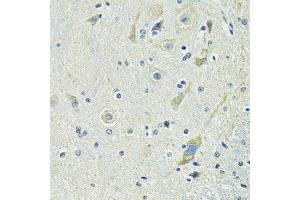 Immunohistochemistry (Paraffin-embedded Sections) (IHC (p)) image for anti-Solute Carrier Family 1 (Glutamate/Neutral Amino Acid Transporter), Member 4 (SLC1A4) (AA 140-220) antibody (ABIN6147872)