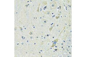 Immunohistochemistry of paraffin-embedded mouse spinal cord using SLC1A4 antibody. (SLC1A4 抗体  (AA 140-220))