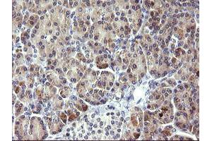 Image no. 1 for anti-Phosphoinositide-3-Kinase, Regulatory Subunit 5 (PIK3R5) antibody (ABIN1500214) (PIK3R5 抗体)