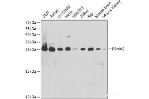 Western blot analysis of extracts of various cell lines using PSMA2 Polyclonal Antibody at dilution of 1:1000. (PSMA2 抗体)