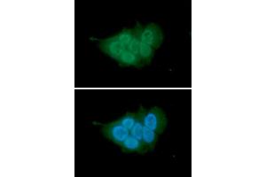 ICC/IF analysis of MCM7 in MCF7 cells.