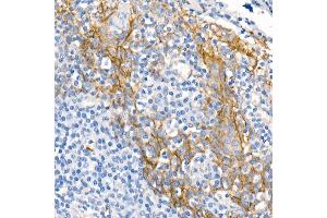 Immunohistochemistry of paraffin-embedded Human tonsil using δ-Catenin/p120 Catenin antibody (ABIN7266144) at dilution of 1:500 (40x lens). (CTNND1 抗体)