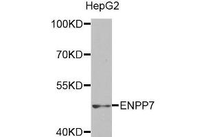 Western blot analysis of extracts of HepG2 cell line, using ENPP7 antibody. (ENPP7 抗体)