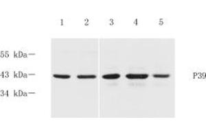Western blot analysis of p39 (ABIN7074968) at dilution of 1: 600,Lane 1: Mouse brain tissue lysate,Lane 2: Mouse cerebral cortex tissue lysate,Lane 3: Rat brain tissue lysate,Lane 4: Rat cerebral cortex tissue lysate,Lane 5: Rat hippocampus tissue lysate (p39 抗体)