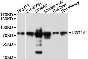 Western blot analysis of extracts of various cell lines, using UGT1A1 antibody. (UGT1A1 抗体)