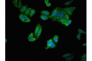 Immunofluorescent analysis of HepG2 cells using ABIN7151655 at dilution of 1:100 and Alexa Fluor 488-congugated AffiniPure Goat Anti-Rabbit IgG(H+L) (ERAP1 抗体  (AA 642-941))