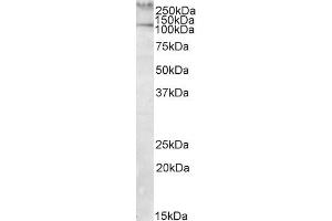 ABIN571042 (1µg/ml) staining of Human Peripheral Mononucleocytes lysate (35µg protein in RIPA buffer). (TLN1 抗体  (Internal Region))