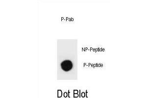 Dot blot analysis of mouse TSC2 Antibody (Phospho ) Phospho-specific Pab (ABIN1881938 and ABIN2839934) on nitrocellulose membrane. (Tuberin 抗体  (pSer1343))