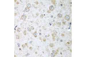 Immunohistochemistry of paraffin-embedded mouse brain using TRH antibody at dilution of 1:100 (40x lens). (TRH 抗体)