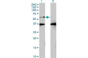 Western Blot analysis of BTBD9 expression in transfected 293T cell line by BTBD9 monoclonal antibody (M01), clone 3H3. (BTBD9 抗体  (AA 2-70))