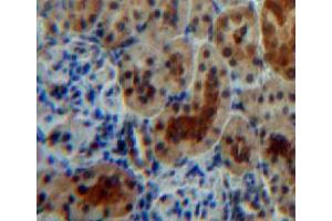 Used in DAB staining on fromalin fixed paraffin-embedded kidney tissue (ACP1 抗体  (AA 1-158))