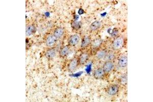 Immunohistochemical analysis of HSD17B2 staining in rat brain  formalin fixed paraffin embedded tissue section. (HSD17B2 抗体)