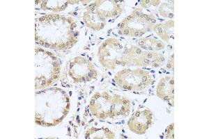 Immunohistochemistry of paraffin-embedded human stomach using CGB7 antibody (ABIN5974696) at dilution of 1/100 (40x lens). (CGB7 抗体)