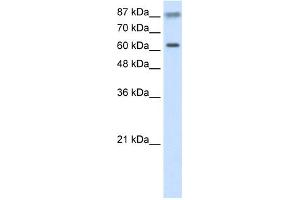 WB Suggested Anti-TRIM35 Antibody Titration:  2. (TRIM35 抗体  (C-Term))