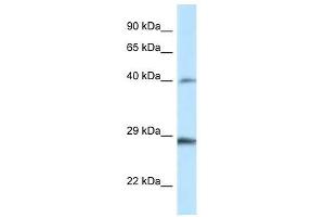 Western Blot showing Hoxb9 antibody used at a concentration of 1. (HOXB9 抗体  (Middle Region))