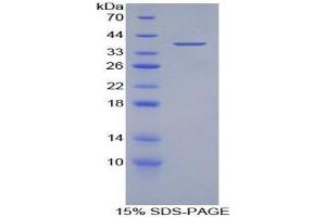 SDS-PAGE analysis of Human Myelin Basic Protein. (MBP 蛋白)