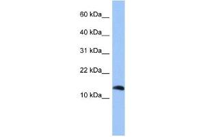 PTH2 antibody used at 1 ug/ml to detect target protein. (Parathyroid 激素 2 (PTH2) (Middle Region) 抗体)