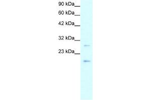 Claudin 1 antibody used at 1-5 ug/ml to detect target protein.