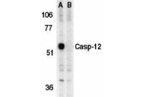 Western blot analysis of caspase-12 in mouse brain tissue lysate in the absence (A) or presence (B) of blocking peptide with AP30191PU-N caspase-12 antibody (IN) at 1 μg/ml. (Caspase 12 抗体  (Intermediate Domain))