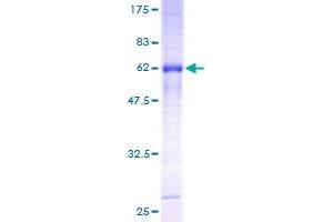 Image no. 1 for Tumor-Associated Calcium Signal Transducer 2 (TACSTD2) (AA 27-323) protein (GST tag) (ABIN1322051)