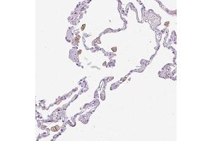 Immunohistochemical staining (Formalin-fixed paraffin-embedded sections) of human lung with SIGLEC1 polyclonal antibody  shows distinct membranous positivity in macrophages. (Sialoadhesin/CD169 抗体  (AA 1425-1510))