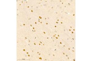 Immunohistochemistry of paraffin embedded mouse brain using RAPGEF5 (ABIN7075365) at dilution of 1:700 (400x lens) (GFR 抗体)