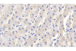 Detection of LTF in Bovine Liver Tissue using Polyclonal Antibody to Lactoferrin (LTF) (Lactoferrin 抗体  (AA 25-352))