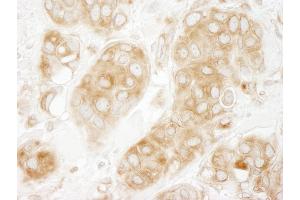 Immunohistochemistry (IHC) image for anti-GIT1 (GIT1) (AA 375-425) antibody (ABIN7448580)