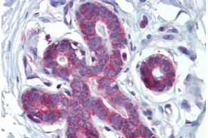 Human Breast (formalin-fixed, paraffin-embedded) stained with HOXA5 antibody ABIN462218 followed by biotinylated goat anti-rabbit IgG secondary antibody ABIN481713, alkaline phosphatase-streptavidin and chromogen. (HOXA5 抗体  (C-Term))