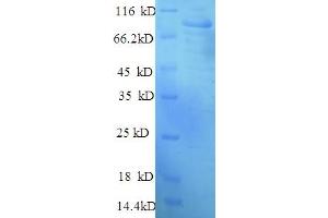 SDS-PAGE (SDS) image for Hexokinase 1 (HK1) (AA 1-917), (full length) protein (His tag) (ABIN5709665)