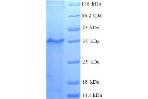 SDS-PAGE (SDS) image for Myosin Light Chain, phosphorylatable, Fast Skeletal Muscle (MYLPF) (AA 2-169) protein (His-SUMO Tag) (ABIN5711709)
