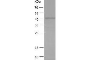 Western Blotting (WB) image for Keratin 18 (KRT18) (AA 1-430) protein (His tag) (ABIN7123674) (Cytokeratin 18 Protein (AA 1-430) (His tag))