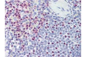 Spleen, Human: Formalin-Fixed, Paraffin-Embedded (FFPE) (PKD1 抗体)