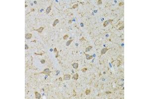 Immunohistochemistry of paraffin-embedded mouse brain using DHRS2 antibody. (DHRS2 抗体  (AA 1-300))