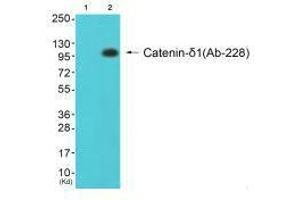 Western blot analysis of extracts from 293 cells (Lane 2), using Catenin-δ1 (Ab-228) antiobdy. (CTNND1 抗体  (Tyr228))