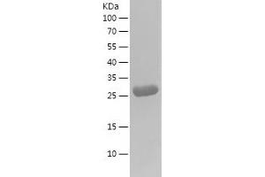 Western Blotting (WB) image for Galectin 3 (LGALS3) (AA 2-250) protein (His tag) (ABIN7123041)