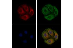 ABIN6255757 and ABIN6267340 staining Hela cells(4h of LPS treatment) by IF/ICC. (c-MET 抗体  (pTyr1003))