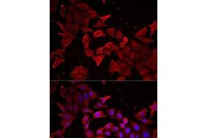 Immunofluorescence analysis of MCF7 cells using Caspase-14 Polyclonal Antibody (CASP14 抗体)