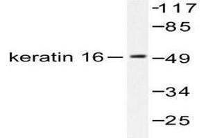 Image no. 1 for anti-Keratin 16 (KRT16) antibody (ABIN265495) (KRT16 抗体)